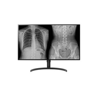 LG 32HL512D-B écran plat de PC 80 cm (31.5") 3840 x 2160 pixels Full HD LCD Noir